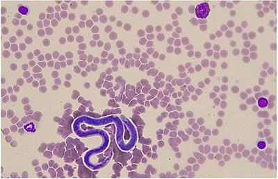 Incidental Detection of Onchocerca Microfilariae in Donkeys (Equus asinus) in Italy: Report of Four Cases